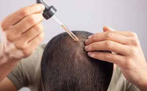 Mężczyzna aplikuje serum na skórę głowy, walcząc z przetłuszczającą się skórą głowy i problemami z włosami.