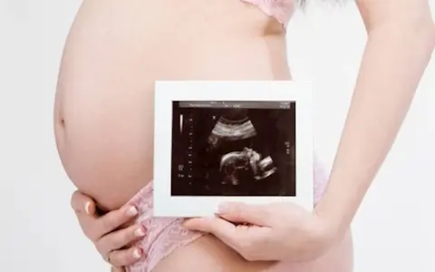 Ciężarna kobieta trzyma zdjęcie USG. To badanie, które pokazuje, co oznacza rozwój dziecka.