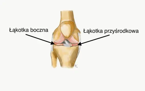 Ilustracja anatomiczna stawu kolanowego z zaznaczonymi łąkotkami: boczną i przyśrodkową.