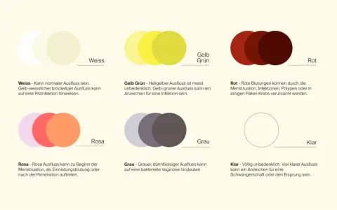 Farbtafel zeigt verschiedene Ausflussfarben: weiß, gelb-grün, rot, rosa, grau und klar. Grauer, dünnflüssiger Ausfluss kann auf eine bakterielle Vaginose hindeuten, manchmal auch schleimiger Ausfluss.
