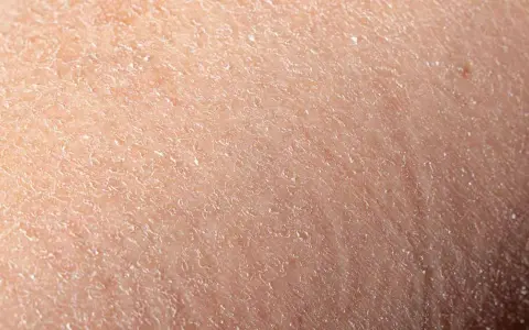 Ursachen und Lösungen für trockene schuppige Gesichtshaut verstehen