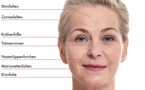 Nahaufnahme einer Frau mit Stirnfalten, Zornesfalten und Krähenfüßen. Selbst mit 20 Jahren können erste Zeichen der Hautalterung sichtbar werden.