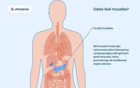 Ilustracja pokazuje lokalizację trzustki i opisuje objawy chorej wątroby i trzustki: ból brzucha promieniujący do pleców.