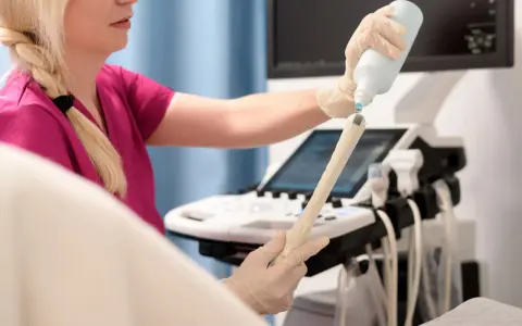 Lekarka przygotowuje sondę USG, aplikując żel. Badanie oceni m.in. grubość endometrium normy.