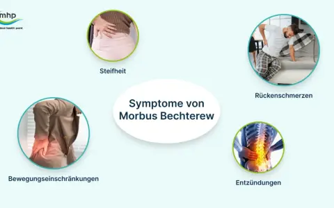 Symptome von Morbus Bechterew: Steifheit, Rückenschmerzen, Bewegungseinschränkungen und Entzündungen der Wirbelsäule.