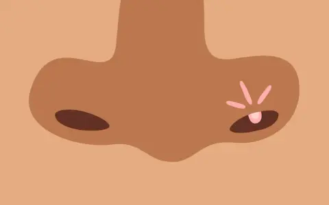 Gros plan sur un nez avec un bouton rose et des rayons de lumière.