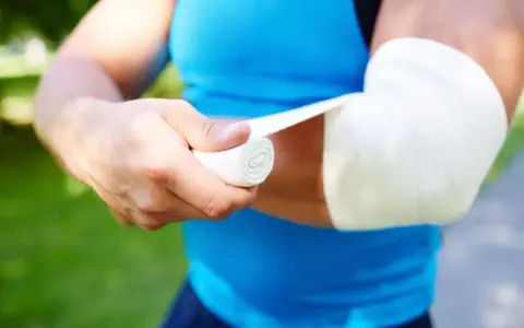 Person bandagiert Arm. Frage: was zahlt die unfallversicherung bei sehnenriss?