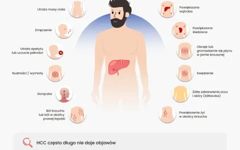 Ilustracja przedstawia sylwetkę mężczyzny z zaznaczonymi objawami nowotworu wątroby.
