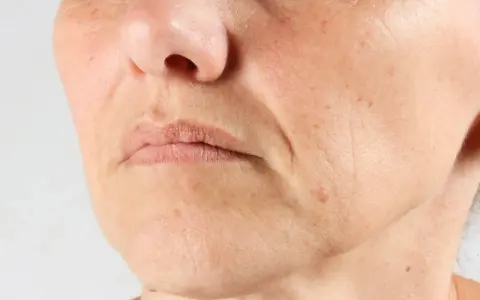 Nahaufnahme eines Gesichts mit sichtbaren Falten um den Mund. Die Frage "Falten ab wann?" beschäftigt viele.