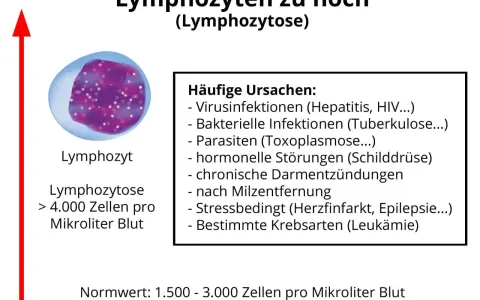 Erhöhte Lymphozyten (Lymphozytose) über 4.000/µl Blut. Ursachen: Infektionen, Parasiten, hormonelle Störungen, Stress, Krebs.