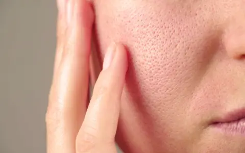 Gros plan sur la joue d'une personne, montrant les pores de la peau. Des doigts effleurent délicatement la surface.