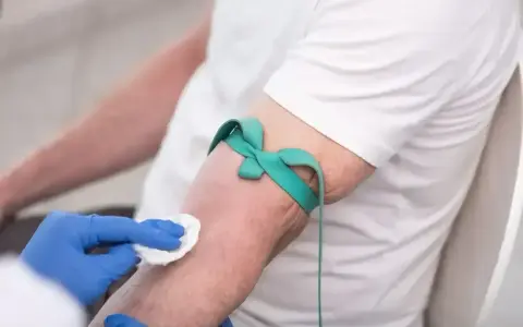 Ręka pacjenta z opaską uciskową i wacikiem przygotowywana do pobrania krwi na badanie HBs antygen.
