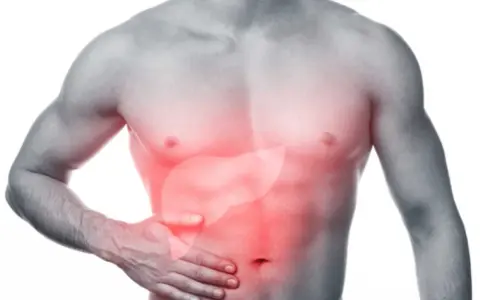 Uomo con un'area rossa evidenziata sull'addome, che indica un problema al fegato, forse metastasi fegato.