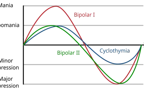 Grafen visar svängningar i sinnesstämning för bipolär I, bipolär II och cyklotymi. För att förstå vad betyder depression, se hur kurvorna sjunker.