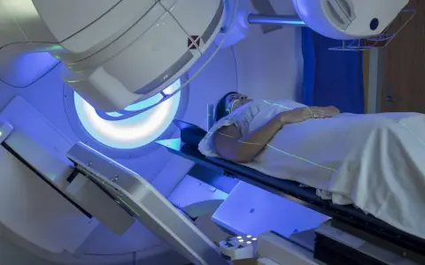 Pacjentka leży na stole terapeutycznym pod aparatem do radioterapii. Zielone linie laserowe wyznaczają pole napromieniania. To właśnie radioterapia co to jest – nowoczesna metoda leczenia.