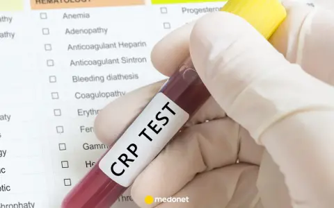 Ręka w rękawiczce trzyma probówkę z krwią z napisem "CRP TEST" na tle listy badań.