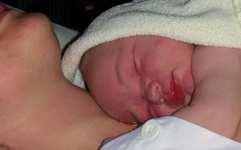 Nyfödd bebis med lite eksem på halsen, tätt intill mammas hud.