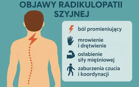 Grafika ilustruje objawy radikulopatii szyjnej: piekący ból kręgosłupa szyjnego, mrowienie, osłabienie mięśni i zaburzenia koordynacji.