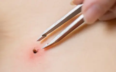 Kawałek kleszcza w skórze? Spokój i instrukcja: weterynarz czy obserwacja?