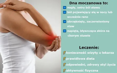Dna moczanowa objawia się nagłym bólem stawu, obrzękiem i zaczerwienieniem. Leczenie obejmuje wizytę u lekarza, dietę i aktywność fizyczną.