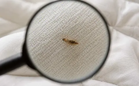 Pod lupą widać wszy na pościeli. Dowiedz się, ile żyją wszy na pościeli i jak się ich pozbyć.