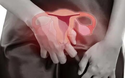 Kobieta z dłońmi zasłaniającymi podbrzusze, na którym widoczny jest schemat narządów rodnych. Może to symbolizować krwawienie po histeroskopii.