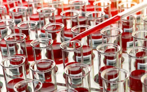Próbówki z krwią do badań nad ostrą białaczką szpikową. Kropelka krwi spada z pipety, symbolizując postęp w diagnostyce i leczeniu.