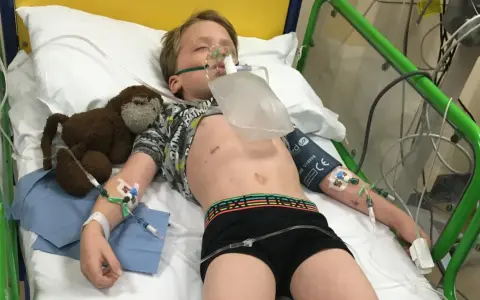 Chłopiec w szpitalnym łóżku z maską tlenową, podłączony do aparatury. To obraz walki z zapaleniem opon mózgowych u dzieci.