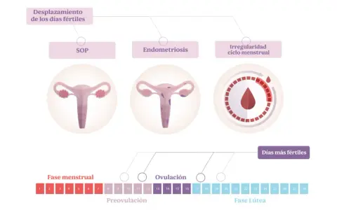 Ilustración del ciclo menstrual y condiciones que afectan la fertilidad. Puedes quedar embarazada si tienes relaciones sexuales en tus días fértiles, incluso si hay irregularidades.