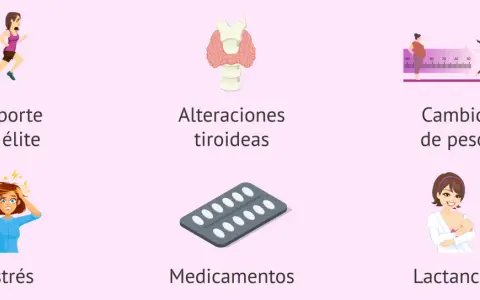 Ilustraciones de causas comunes de retraso regla: deporte, tiroides, peso, estrés, medicamentos y lactancia.