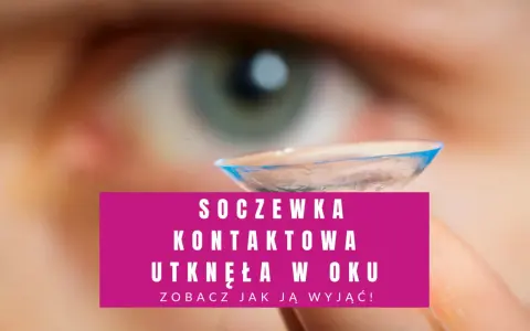 Nie mogę znaleźć soczewki w oku? Zobacz, jak wyjąć soczewkę kontaktową, która utknęła w oku.