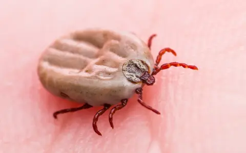 Makro zbliżenie na kleszcza, który przyczepił się do ludzkiej skóry. Ten pasożyt jest groźny na kleszcze.