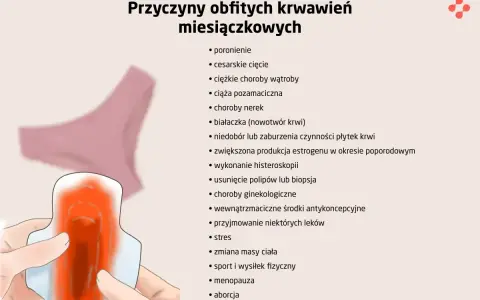 Ilustracja przedstawia higieniczną podpaskę z widocznym krwawieniem, symbolizującą, ile krwi traci kobieta podczas okresu. Obok lista przyczyn obfitych krwawień.