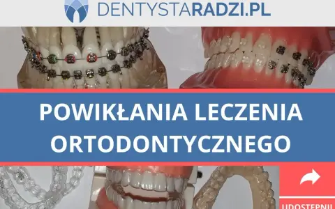 Ból zębów po aparacie? Szybka ulga i porady ortodonty!