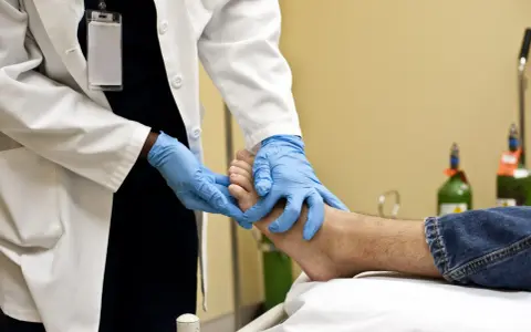 Un professionnel de santé examine un pied, possiblement pour une plaie diabétique, avec des gants bleus. L'application de bétadine est une étape courante pour le soin des plaies.