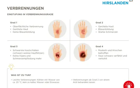 Verbrühungen: Grad 2 zeigt gerötete Haut, Blasenbildung und starke Schmerzen. Ein Arzt sollte ab Grad 2 konsultiert werden.