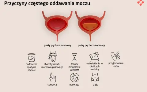 Ilustracja pokazuje przyczyny częstego oddawania moczu: nadmierne picie, choroby, wiek, nadwagę, ciążę i leki.