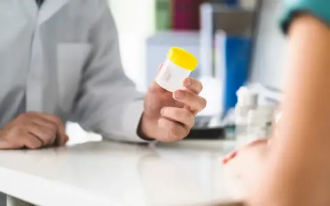 Lekarz podaje pacjentowi pojemnik na mocz, sugerując potrzebę diagnostyki w kierunku krwiomoczu, co jest pierwszym krokiem do ustalenia leczenia domowego.