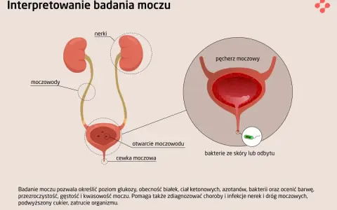 Ilustracja układu moczowego z zaznaczonymi nerkami, moczowodami i pęcherzem. W powiększeniu widoczne bakterie w moczu.
