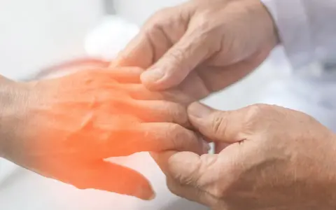 Lekarz bada dłoń z zaczerwienieniem, sugerującym objawy skórne związane z helicobacter pylori.