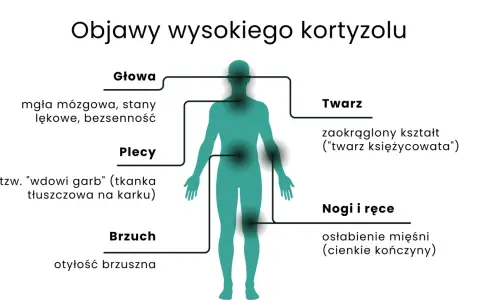 Wysoki kortyzol objawia się mgłą mózgową, lękami, bezsennością, "twarzą księżycowatą", garbkiem tłuszczowym na karku, otyłością brzuszną i osłabieniem mięśni.