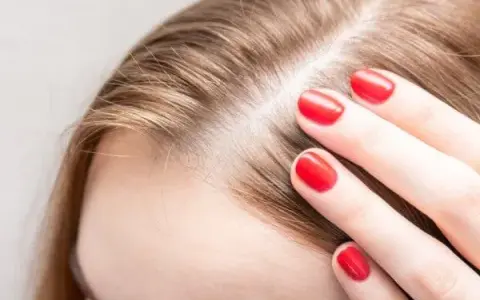 Dünnes Haar und sichtbare Kopfhaut bei Frauen: Ursachen und Lösungen