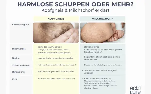 Baby kratzt sich am Kopf wegen Kopfgneis oder Milchschorf. Die Bilder zeigen die Unterschiede.