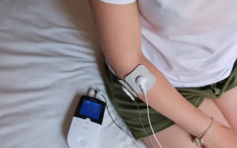 Traitement d'une épicondylite, maladie professionnelle, avec un appareil d'électrostimulation sur le bras.