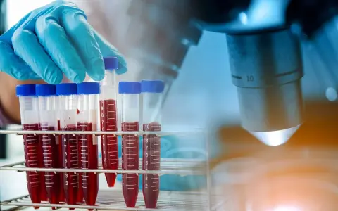 Rękawiczka laboratoryjna trzyma probówkę z krwią na tle mikroskopu.