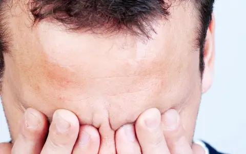 Mann mit Händen vor dem Gesicht, Stirn gerunzelt, als ob er den **exitus letalis** fürchtet.