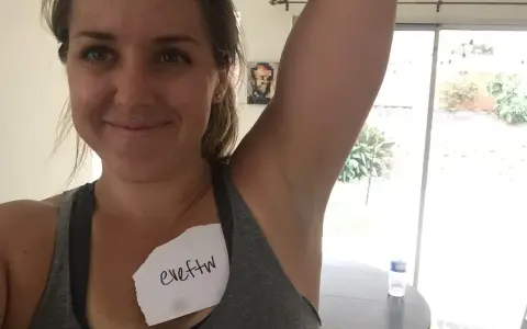 Kvinna visar sin armhåla, som har viss hyperpigmentering. En lapp med texten "eveftw" sitter på hennes bröst.