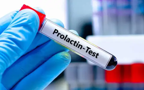 Hiperprolaktynemia: Gdy psychika cierpi przez hormony. Objawy i leczenie