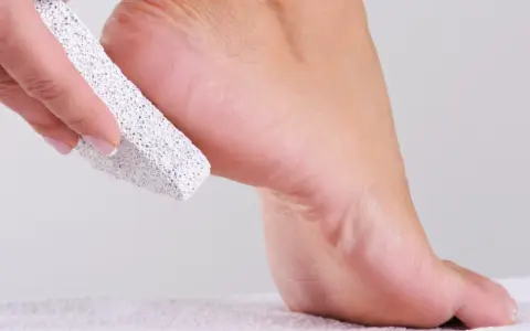 Piedra pómez exfolia el talón para eliminar olor de pies para siempre.