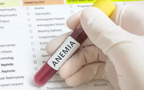 Badanie krwi potwierdza niskie erytrocyty w ciąży. Wynik wskazuje na anemię, która wymaga dalszej diagnostyki.